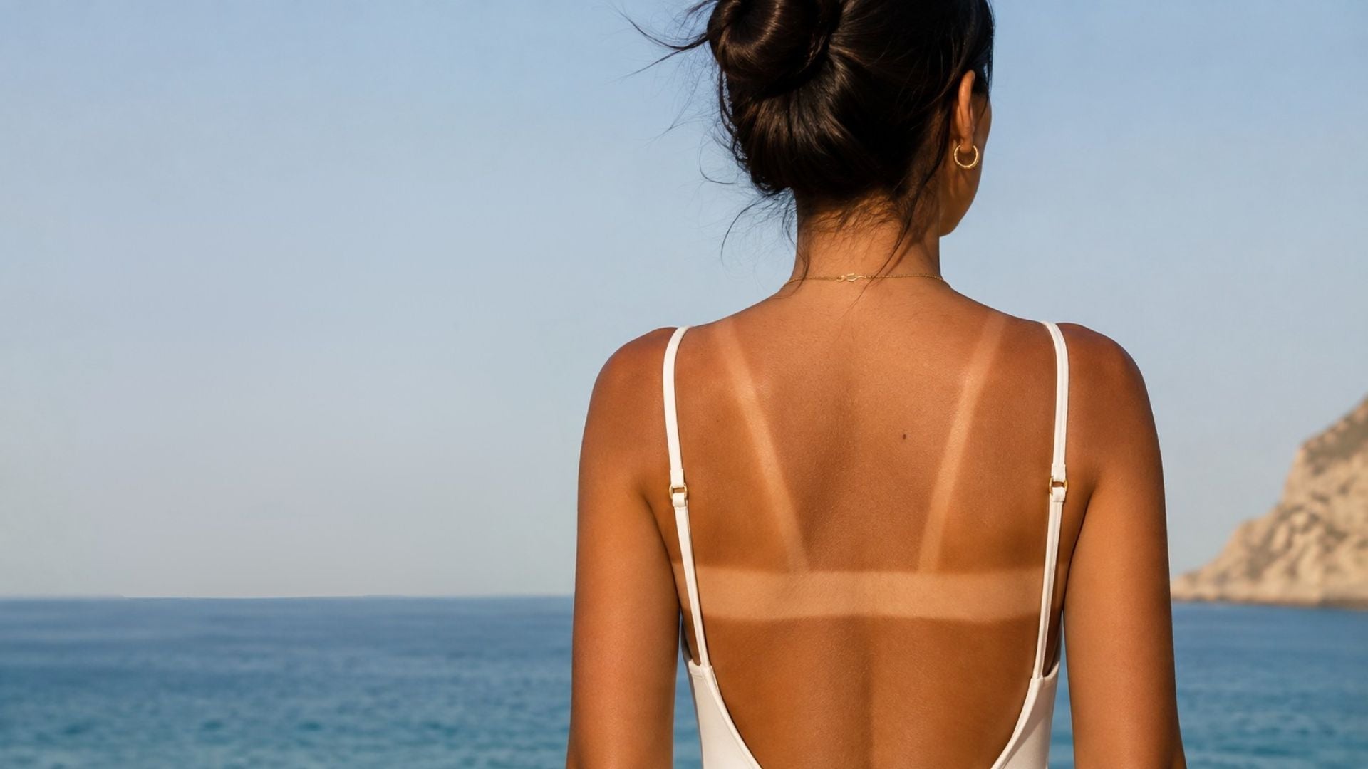Burn lines : quand les réseaux sociaux mettent votre peau en danger